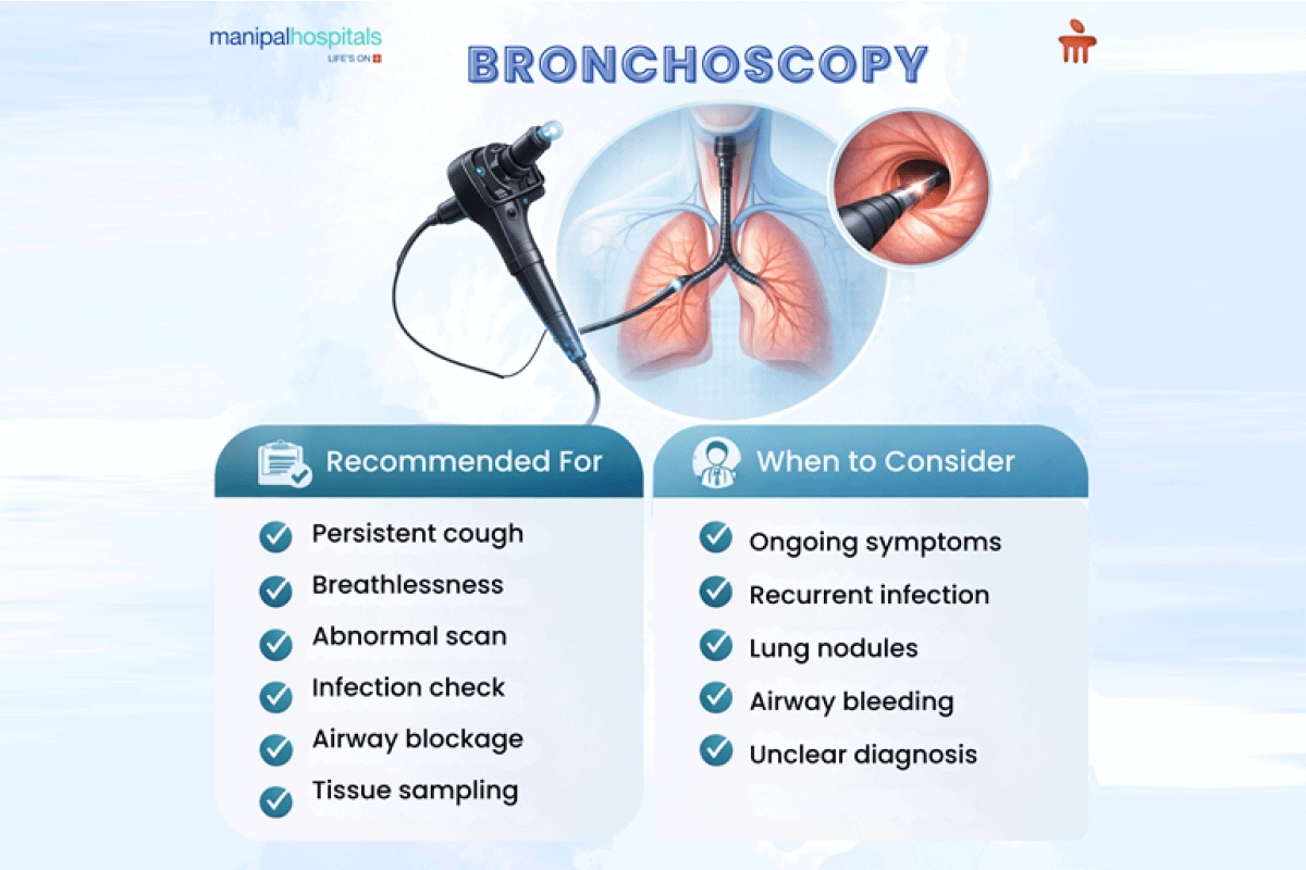 Bronchoscopy test for detecting lung conditions