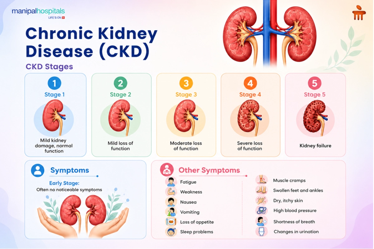 Chronic Kidney Disease: Stages and Symptoms