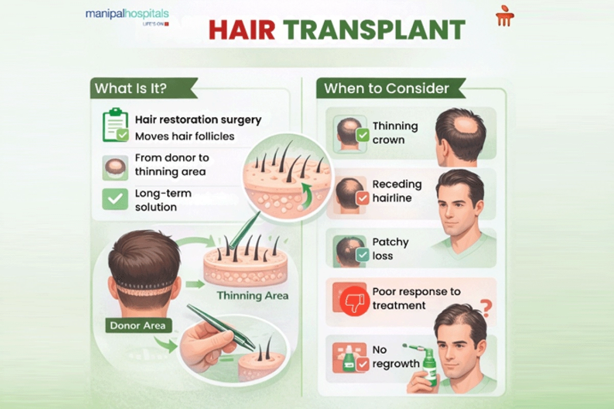 hair transplant surgery procedure