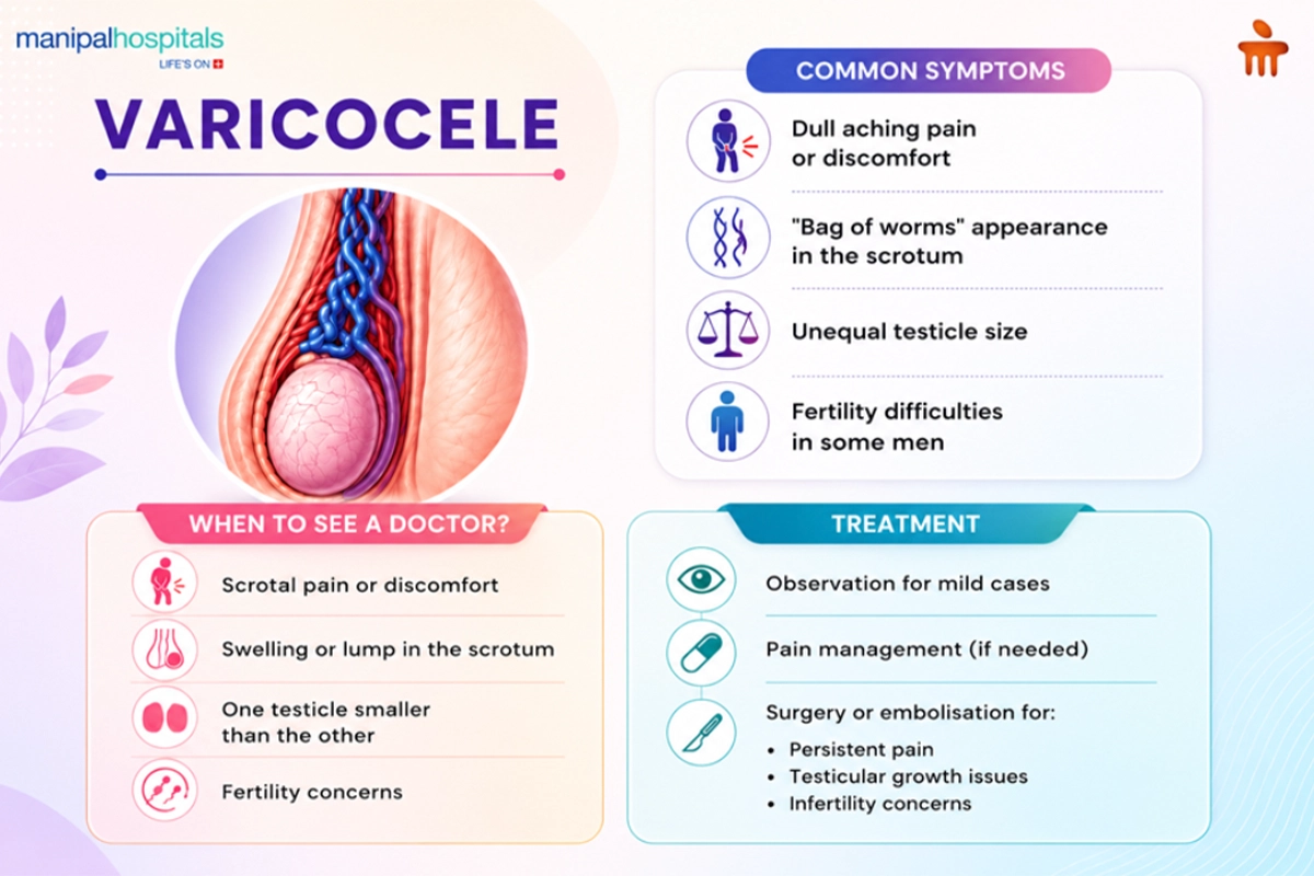 Varicocele symptoms, diagnosis, and treatment
