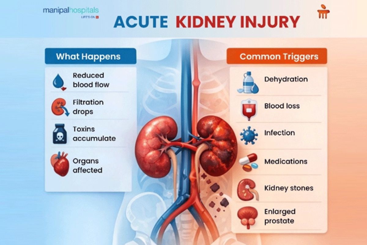 Acute kidney injury symptoms, causes & treatment